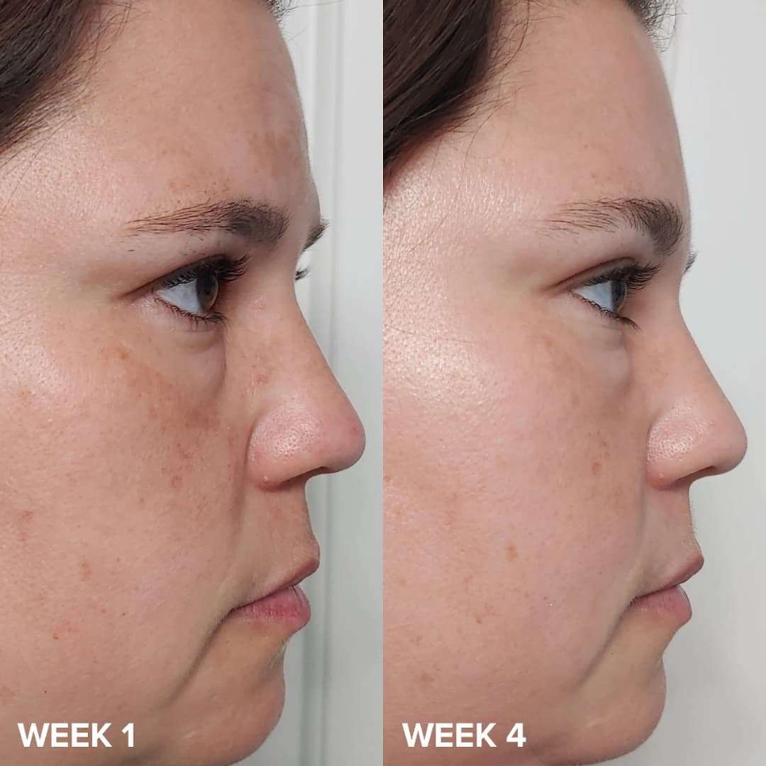 Paula's Choice - Exfoliante líquido perfeccionador de piel con 2% BHA - Imagen 2